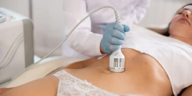 New Client Cryotherapy using Glypto Technology (Tummy or Back Area)