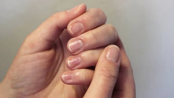 Dip Removal with Service