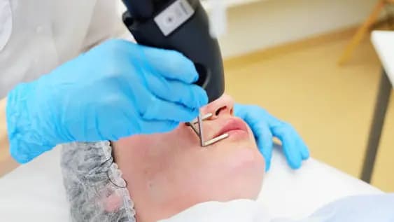 Cherry Angiomas Removal - Up to 20