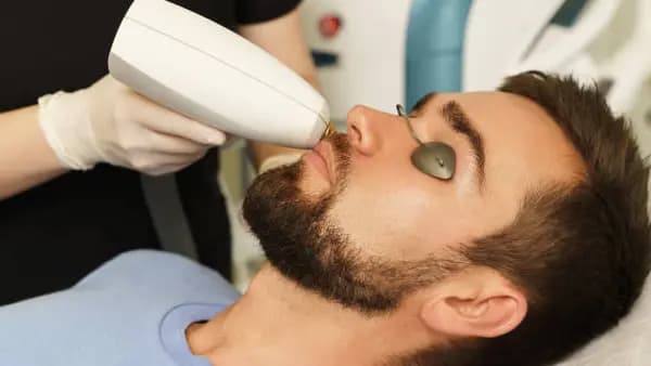 Cherry Angiomas Removal - Up to 10