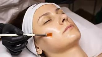 Chemical Peel - Topix Perfect 10- Intermediate