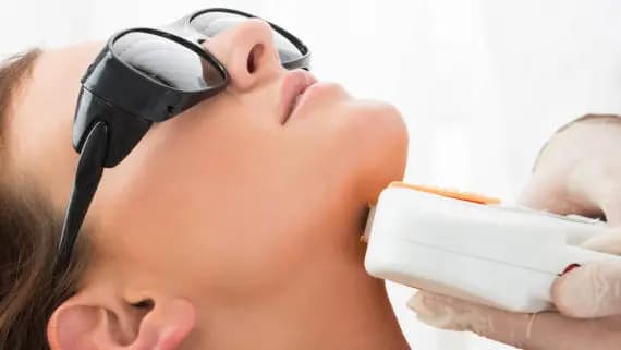 IPL - Face Neck & Chest